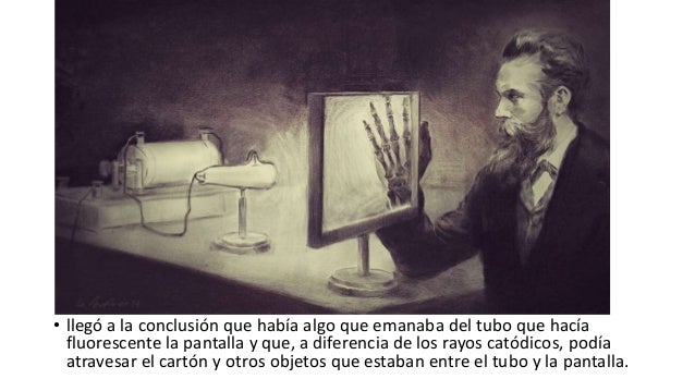 historia rayos x