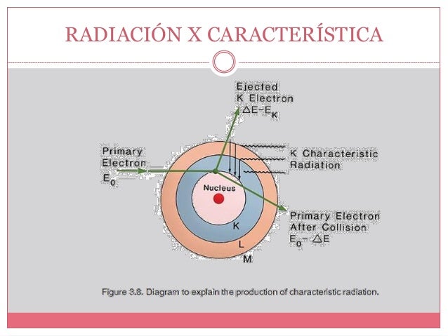 Rayos X - Cristina Santos