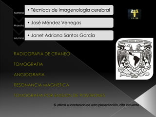 Materia
          • Técnicas de imagenología cerebral


Maestro
          • José Méndez Venegas


Alumna
          • Janet Adriana Santos García
 