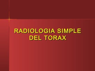 RADIOLOGIA SIMPLERADIOLOGIA SIMPLE
DEL TORAXDEL TORAX
 