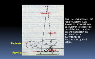 POR LA CAPACIDAD DE
PENETRACION, LOS
RAYOS X ATRAVIESAN
EL CUERPO. INCIDEN EN
LA PELÍCULA, LA CUAL
ES ENNEGRECIDA DE
ACUERDO A LA
CANTIDAD DE
RADIACION QUE LE
LLEGA.
Tubo de RX
Paciente
Parrilla
Haz de RX
Película
 