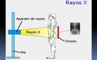 GENERALIDADES
En el cuerpo humano la absorción es
alta en los huesos y baja en los
músculos y otros tejidos blandos.
Así pues, el examen radiográfico
consiste en irradiar una parte del
paciente con un haz uniforme de
rayos x y registrar los rayos de
salida sobre una película de doble
emulsión.
 