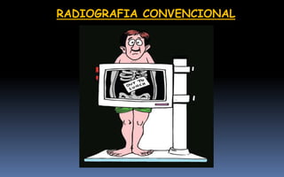 RADIOGRAFIA CONVENCIONAL
 