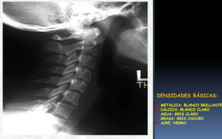 Distribución en el cuerpo de las
densidades radiológicas que se
consideran básicas: aire (gas),
agua, grasa, calcio (ósea) y
densidad metálica, determinan
lo que se distingue en la
radiografías normales.
DENSIDADES BÁSICAS:
1. METALICA: BLANCO BRILLANTE
2. CALCICA: BLANCO CLARO
3. AGUA: GRIS CLARO
4. GRASA: GRIS OSCURO
5. AIRE: NEGRO
1
2
3
4
5
 