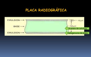 PLACA RADIOGRÁFICA
Acetato de celulosa
Halogenuros de plata
 