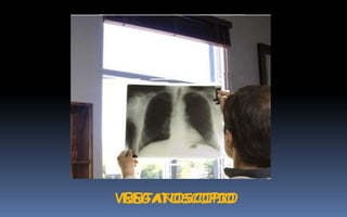 NEGATOSCOPIOVENTANOSCOPIO
 