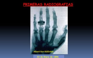 PRIMERAS RADIOGRAFIAS
Anna Berta
22 de Diciembre de 189523 de Enero de 1896
AlbertVon Köllinker
 