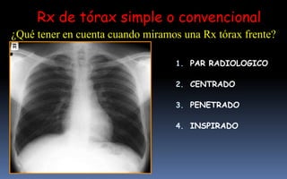 1. PAR RADIOLOGICO
2. CENTRADO
3. PENETRADO
4. INSPIRADO
Rx de tórax simple o convencional
¿Qué tener en cuenta cuando miramos una Rx tórax frente?
 