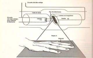 TUBO DE RAYOS X:
 