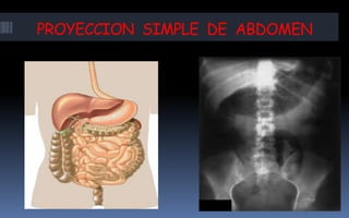 PROYECCION SIMPLE DE ABDOMEN
 