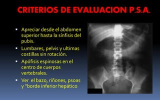 CRITERIOS DE EVALUACION P.S.A.
 Apreciar desde el abdomen
superior hasta la sínfisis del
pubis.
 Lumbares, pelvis y ultimas
costillas sin rotación.
 Apófisis espinosas en el
centro de cuerpos
vertebrales.
 Ver el bazo, riñones, psoas
y “borde inferior hepático
 
