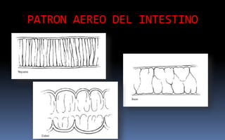 PATRON AEREO DEL INTESTINO
 