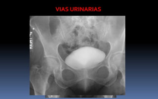 VIAS URINARIAS
 