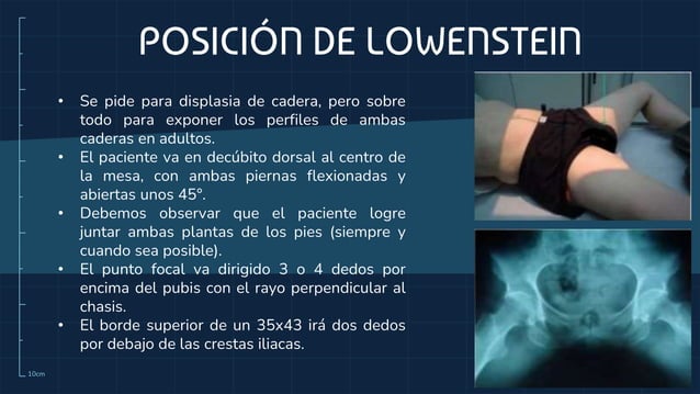 Lowenstein Rx rayos x miembros inferiores.pptx