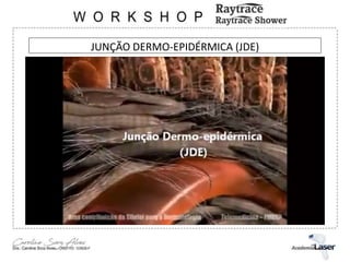 JUNÇÃO DERMO-EPIDÉRMICA (JDE)
 