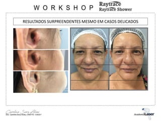 RESULTADOS SURPREENDENTES MESMO EM CASOS DELICADOS
 