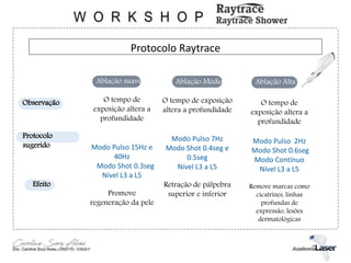 Protocolo Raytrace
Observação
Protocolo
sugerido
Efeito
Ablação suave Ablação Alta
Ablação Média
O tempo de exposição
altera a profundidade
Modo Pulso 7Hz
Modo Shot 0.4seg e
0.5seg
Nível L3 a L5
Retração de pálpebra
superior e inferior
O tempo de
exposição altera a
profundidade
Modo Pulso 15Hz e
40Hz
Modo Shot 0.3seg
Nível L3 a L5
Promove
regeneração da pele
O tempo de
exposição altera a
profundidade
Modo Pulso 2Hz
Modo Shot 0.6seg
Modo Contínuo
Nível L3 a L5
Remove marcas como
cicatrizes, linhas
profundas de
expressão, lesões
dermatológicas
 