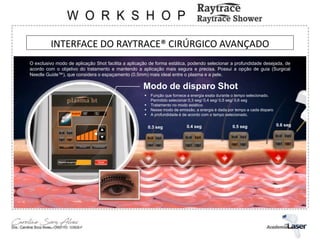 INTERFACE DO RAYTRACE® CIRÚRGICO AVANÇADO
Modo de disparo Shot
 Função que fornece a energia exata durante o tempo selecionado.
Permitido selecionar 0,3 seg/ 0,4 seg/ 0,5 seg/ 0,6 seg
 Tratamento no modo estático
 Nesse modo de emissão, a energia é dada por tempo a cada disparo
 A profundidade é de acordo com o tempo selecionado.
0.3 seg 0.4 seg 0.5 seg 0.6 seg
O exclusivo modo de aplicação Shot facilita a aplicação de forma estática, podendo selecionar a profundidade desejada, de
acordo com o objetivo do tratamento e mantendo a aplicação mais segura e precisa. Possui a opção de guia (Surgical
Needle Guide™), que considera o espaçamento (0.5mm) mais ideal entre o plasma e a pele.
 