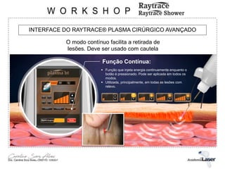 INTERFACE DO RAYTRACE® PLASMA CIRÚRGICO AVANÇADO
Função Contínua:
 Função que injeta energia continuamente enquanto o
botão é pressionado. Pode ser aplicada em todos os
modos.
 Utilizada, principalmente, em todas as lesões com
relevo.
O modo contínuo facilita a retirada de
lesões. Deve ser usado com cautela
 