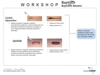Cicatriz
Hipertrófica
• Aplique anestésico. Sugestão: injetável
(procedimento médico) ou creme anestésico de sua
preferência conforme instrução de uso (pode-se
usar o Raytrace Shower antes para aumentar a
absorção)
• Aplique em toda cicatriz
• Modo Contíuo L2-L5
Quelóide
• Aplique anestésico. Sugestão: injetável (procedimento
médico) ou creme anestésico de sua preferência
conforme instrução de uso (pode-se usar o Raytrace
Shower antes para aumentar a absorção)
• Faça pontos por toda cicatriz.
• Modo Contínuo L4-L5.
Pode ser utilizado
antibiótico tópico após
procedimento de acordo
com indicação médica
 