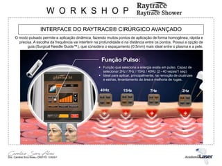 INTERFACE DO RAYTRACE® CIRÚRGICO AVANÇADO
O modo pulsado permite a aplicação dinâmica, fazendo muitos pontos de aplicação de forma homogênea, rápida e
precisa. A escolha da frequência vai interferir na profundidade e na distância entre os pontos. Possui a opção de
guia (Surgical Needle Guide™), que considera o espaçamento (0.5mm) mais ideal entre o plasma e a pele.
Função Pulso:
 Função que seleciona a energia exata em pulso. Capaz de
selecionar 2Hz / 7Hz / 15Hz / 40Hz (2 - 40 vezes/1 seg)
 Ideal para aplicar, principalmente, na remoção de cicatrizes
e estrias, levantamento da área e melhoria de rugas.
40Hz 15Hz 7Hz 2Hz
 