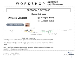 PROTOCOLO RAYTRACE
Modos Cirúrgicos
Protocolo Cirúrgico Ablação média
Ablação suave
Rugas Profundas
Efeito lifiting
Íons de Plasma
(estimulação de colágeno) Regeneração de pele
Modo Pulse 15 Hz L3-L5
Para ablação suave (centro da ruga): aplique em escaneamento, movimento dinâmico “rápido”
Para ablação média (ao redor da ruga): aplique em escaneamento, movimento dinâmico
“lento”
Obs.: a velocidade influencia na quantidade de energia liberada no tecido. Utilize esse fator
para definir a ablação suave da ablação média
 
