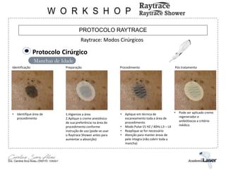 PROTOCOLO RAYTRACE
Raytrace: Modos Cirúrgicos
Manchas de Idade
Protocolo Cirúrgico
Identificação Preparação Procedimento Pós tratamento
• Identifque área de
procedimento
1.Higienize a área
2.Aplique o creme anestésico
de sua preferência na área do
procedimento conforme
instrução de uso (pode-se usar
o Raytrace Shower antes para
aumentar a absorção)
• Aplique em técnica de
escaneamento toda a área de
procedimento
• Modo Pulse 15 HZ / 40Hz L3 – L4
• Reaplique se for necessário
• Atenção para manter áreas de
pele íntegra (não cobrir toda a
mancha)
• Pode ser aplicado creme
regenerador e
anibiótiocos a critério
médico.
 