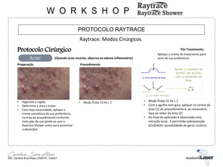 PROTOCOLO RAYTRACE
Raytrace: Modos Cirúrgicos
Protocolo Cirúrgico
Acne (Quando acne recente, observa-se edema inflamatório)
Procedimento
Preparação
• Higienize a região
• Determine a área a tratar.
• Caso haja necessidade, aplique o
creme anestésico de sua preferência
na área do procedimento conforme
instrução de uso (pode-se usar o
Raytrace Shower antes para aumentar
a absorção)
• Modo Pulse 15 Hz L 1
Ajuste o número de
pontos de acordo
com o tamanho da
área
• Modo Pulse 15 Hz L 1
• Com a agulha sem guia, aplique no centro da
área (1) de procedimento e, se necessário,
faça ao redor da área (2)
• Ao final da aplicação é observado uma
retração local. É permitida sobreposição
(CUIDADO: possibilidade de gerar cicatriz).
① 1mm dentro da área
② ao redor da área
Pós Treatmento:
Aplique o creme de tratamento para
acne de sua preferência
 