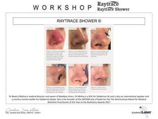 RAYTRACE SHOWER ®
Dr Beatriz Molina is medical director and owner of Medikas clinics. Dr Molina is a KOL for Galderma UK and is also an international speaker and
a country mentor leader for Galderma Global. She is the founder of the IAPCAM and a finalist for the The SkinCeuticals Award for Medical
Aesthetic Practitioner of the Year at the Aesthetics Awards 2017
 