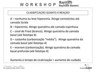 CLASSIFICAÇÃO QUANTO À REAÇÃO
A – nenhuma ou leve hiperemia. Atinge corneócitos até
camada lúcida
B – hiperemia. Atinge queratina até camada espinhosa
C – sinal de Frost (branco). Atinge queratina da camada
basal (até fototipo 6)
D – castanho (carbonização “média”). Atinge queratina da
camada basal (até fototipo 4)
E – marrom (carbonização). Atinge queratina da camada
basal profunda (até fototipo 4)
Aumenta o tempo de cicatrização = aumento do cuidado
 