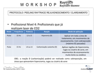 PROTOCOLO: PEELING RAYTRACE REJUVENESCIMENTO / CLAREAMENTO
• Profissional Nível 4: Profissionais que já
realizam laser de CO2
Modo Frequência Potência Reação Modo de aplicação
Pulse 15 Hz L3 a L5 Hiperemia (B) Aplicar em toda a área de
tratamento, em movimentos de
escaneamento. Com sobreposição
(máximo 02 passadas)
Pulse 15 Hz L4 ou L5 Carbonização castanha (D) Aplicar regiões de hipercromia,
rugas ou cicatriz de acne, em
movimentos de escaneamento
muito lento ou estático
OBS.: a reação D (carbonização) poderá ser realizado como sobreposição, em
áreas que apresentem hipercromia, rugas ou cicatriz de acne
 
