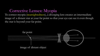 Corrective Lenses: Myopia
To correct myopia (nearsightedness), a diverging lens creates an intermediate
image of a distant star at your far point so that your eye can see it even though
the star is beyond your far point.
far point
image of distant object
 