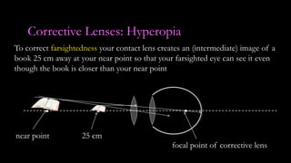 Corrective Lenses: Hyperopia
To correct farsightedness your contact lens creates an (intermediate) image of a
book 25 cm away at your near point so that your farsighted eye can see it even
though the book is closer than your near point
near point 25 cm
focal point of corrective lens
 
