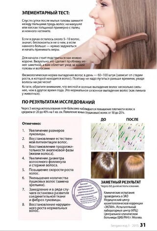 Լա
ЭЛЕМЕНТАРНЫЙТЕСТ:
Спустя сутки после мытья головы зажмите
между пальцами прядь волос на макушке
или висках толщиной примерно с палец
и немного натяните.
Если в руках осталось около 5-10 волос,
значит, беспокоиться не о чем, аесли
намного больше — нужно задуматься
и начать принимать меры.
Для начала стоит подстричься как можно
короче. Визуально это сделает проблему ме­
нее заметной, а вамоблегчит уход за кожей
головы и волосами.
n il 1'тու՛
М ИНИ
Х Ш ш пUVlAAl111
№ ШІ1
m
MSM
J f
■ и
 М Й В І
■ И І
g lD Щ
inn "J
11
Физиологическая норма выпадения волос вдень — 60-100 штук (зависит от стадии
роста, в которой находится волос). Поэтому не надо пугаться раньше времени, увидя
волосы на расческе!
Кстати, обратите внимание, что весной и осенью выпадение волос несколько силь­
нее, чем вдругое время года. Это нормальное сезонное выпадение волос (как линька
у животных).
ПО РЕЗУЛЬТАТАМИССЛЕДОВАНИЙ
Через3месяцаиспользования геля-бальзаманаблюдаетсяповышениеплотностиволосв
среднемот20до40%на1кв.см. Появлениеюных(пушковых) волосот18до25%.
Отмечено:
1. Увеличение размеров
луковицы.
2. Восстановление естествен­
ной пигментации волос.
3. Восстановление продолжи­
тельности анагеновой фазы
(жизни волоса).
4. Увеличение диаметра
волосяного фолликула
и стержня волоса.
5. Повышение скорости роста
волос.
6. Уменьшение количества
пушковых волос (замена
зрелыми).
7. Замедление и в ряде слу­
чаев остановка развития
соединительной ткани
и фиброз луковицы.
8. Восстановление нарушен­
ного роста нормальных
волос.
до ПОСЛЕ
, / ՜ S t ,
/ խ . է
' ' / а А' /1* 1՛ J
/ " . /
Y /.f / / ' ( / • < / / * ՝!
Ш,! /
ran / ա Թ
ж Ш ш т ш і
ЗАМЕТНЫЙ результат
^ Через 60 дней использования.
Клиническиеиспытания
проводилисьвЗАО
Медицинскийцентр
косметологическойкоррекции
«ЭКЛАН»,Испытательный
лабораторныйцентр(ИЛЦ)
Центральнойклинической
больницы(ЦКБРАН)г.Москва.
Sengara изд.1 -2015 31
 