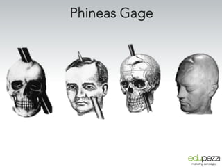 Phineas Gage
 