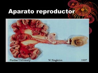 Aparato reproductor
 