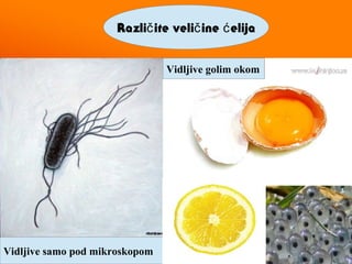 Razli ite veli ine elijač č ć
Vidljive samo pod mikroskopom
Vidljive golim okom
 