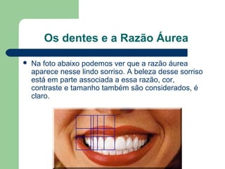 Os dentes e a Razão Áurea
 Na foto abaixo podemos ver que a razão áurea
aparece nesse lindo sorriso. A beleza desse sorriso
está em parte associada a essa razão, cor,
contraste e tamanho também são considerados, é
claro.
 