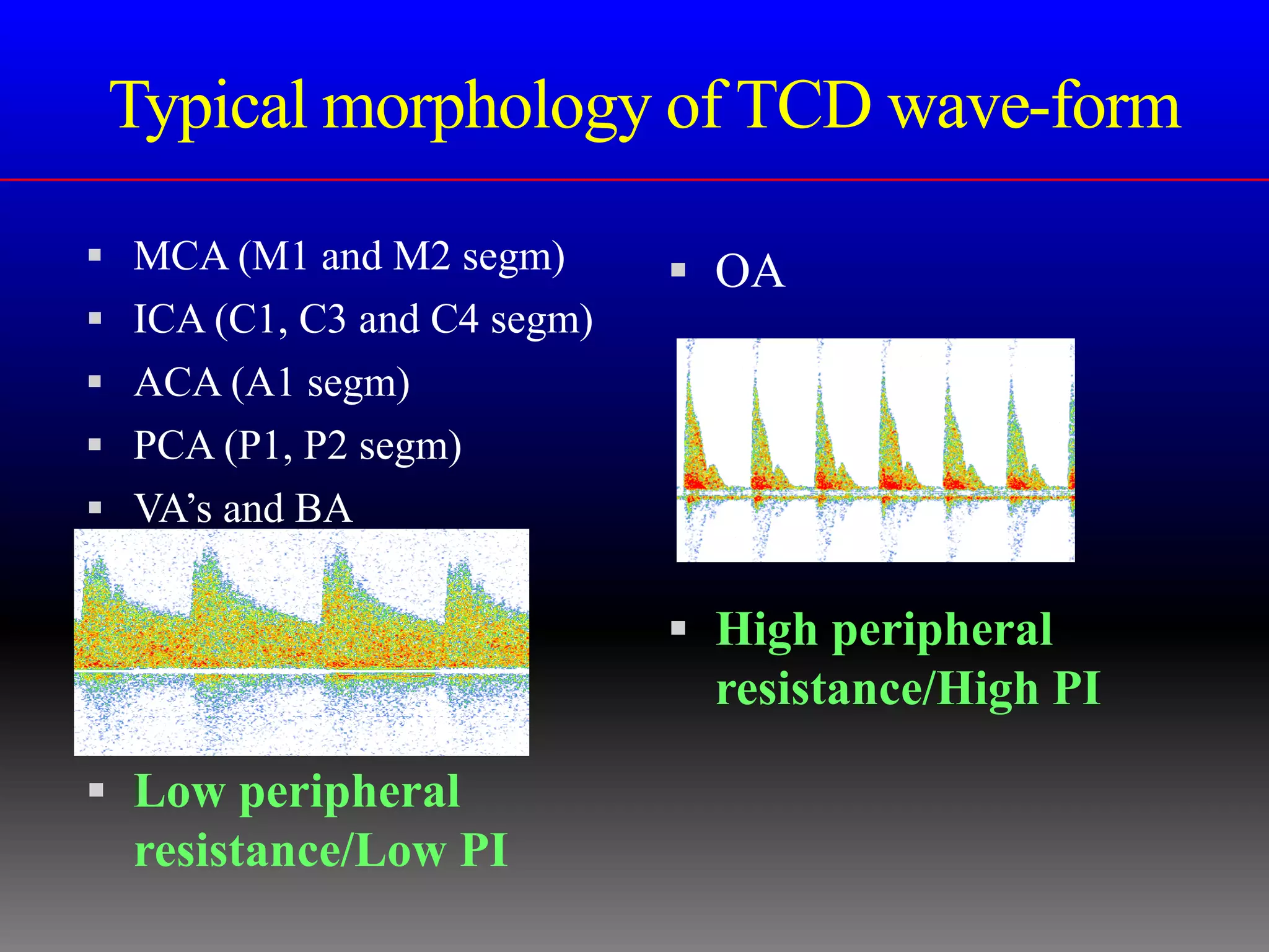 Typical morphology of TCD wave-form

 MCA (M1 and M2 segm)        OA
 ICA (C1, C3 and C4 segm)
 ACA (A1 segm)
 PCA (P1, P2 segm)
 VA’s and BA


                              High peripheral
                               resistance/High PI

 Low peripheral
  resistance/Low PI
 