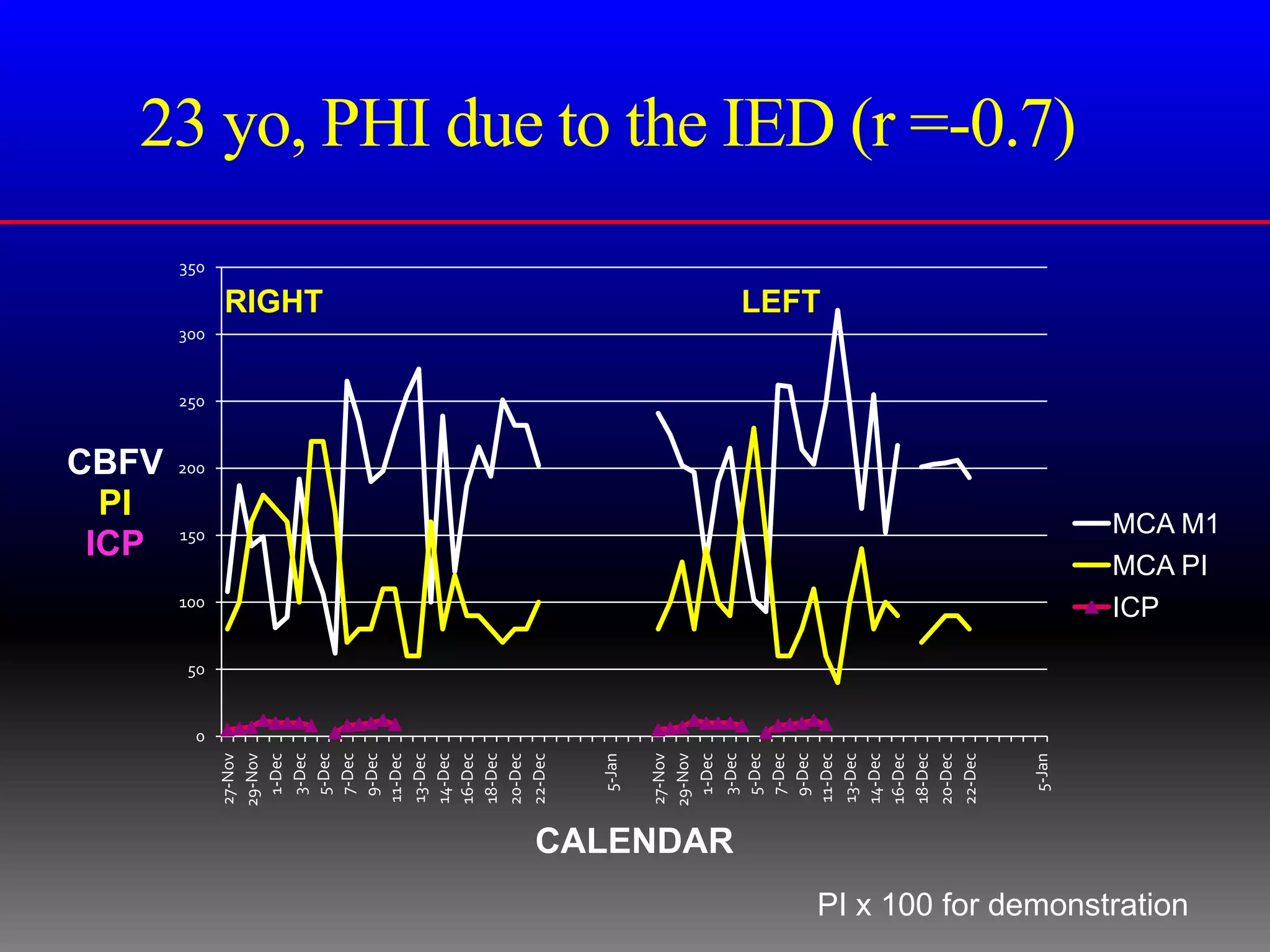 PI
                                                                 ICP
                                                                CBFV
                                                                            250




                                                          100




                                                 0
                                                     50
                                                                                                350




                                                                      200


                                                                150
                                                                                  300
                                        27-Nov
                                        29-Nov
                                         1-Dec
                                         3-Dec                                          RIGHT
                                         5-Dec
                                         7-Dec
                                         9-Dec
                                        11-Dec
                                        13-Dec
                                        14-Dec
                                        16-Dec
                                        18-Dec
                                        20-Dec
                                        22-Dec



                                         5-Jan

                                        27-Nov
                                        29-Nov
                                         1-Dec




                             CALENDAR
                                         3-Dec
                                         5-Dec
                                         7-Dec
                                         9-Dec
                                                                                        LEFT




                                        11-Dec
                                        13-Dec
                                        14-Dec
                                        16-Dec
                                        18-Dec
                                        20-Dec
                                        22-Dec



                                         5-Jan
                                                                                                      23 yo, PHI due to the IED (r =-0.7)




                                                          ICP




PI x 100 for demonstration
                                                          MCA PI
                                                          MCA M1
 