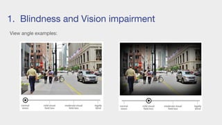 1. Blindness and Vision impairment
View angle examples:
 