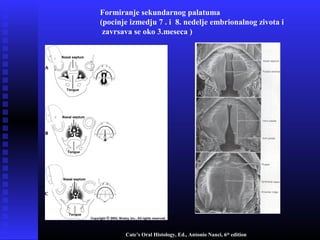 Formiranje sekundarnog palatuma
(pocinje izmedju 7 . i 8. nedelje embrionalnog zivota i
zavrsava se oko 3.meseca )
Cate’s Oral Histology, Ed., Antonio Nanci, 6th
edition
 