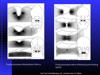 Fuzija procesusa eliminacijom zlebova Fuzija procesusa nakon eliminacije povrsinskog
epitela
Ten Cate’s Oral Histology, Ed., Antonio Nanci, 6th
edition
 