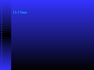 13-17mm
 