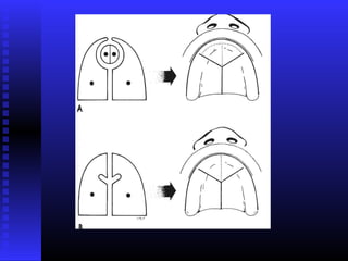 Razvoj lica i vilica