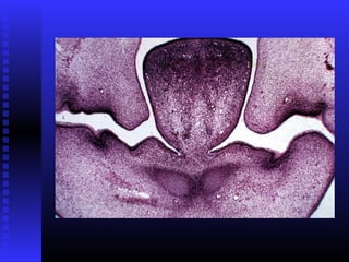 Razvoj lica i vilica