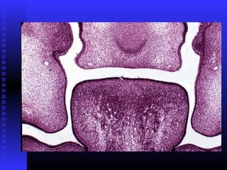 Razvoj lica i vilica