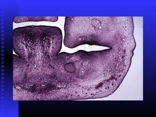 Razvoj lica i vilica