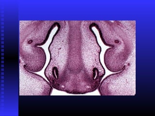 Razvoj lica i vilica