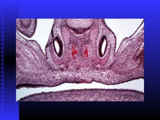 Razvoj lica i vilica